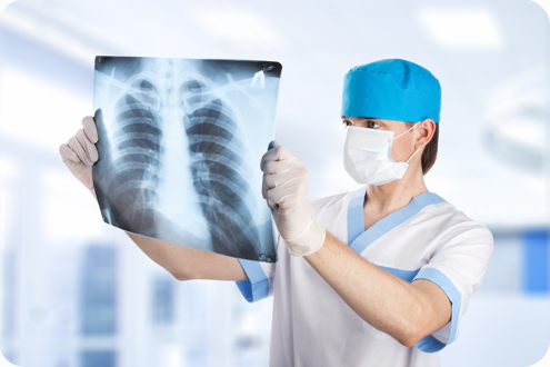 рентген при туберкулезе