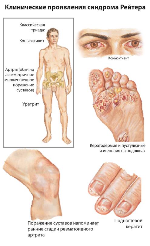 artroza articulațiilor dureri de genunchi dureri articulare cu vibrații